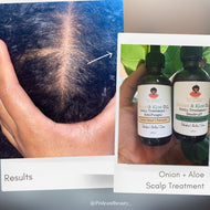 Onion Oil | Aloe Vera Oil