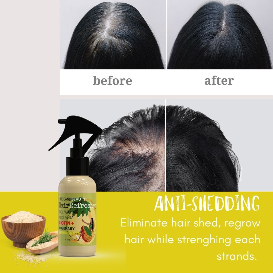Fermented Rice Water + Aloe Hair Growth Spray – Prideandbeauty