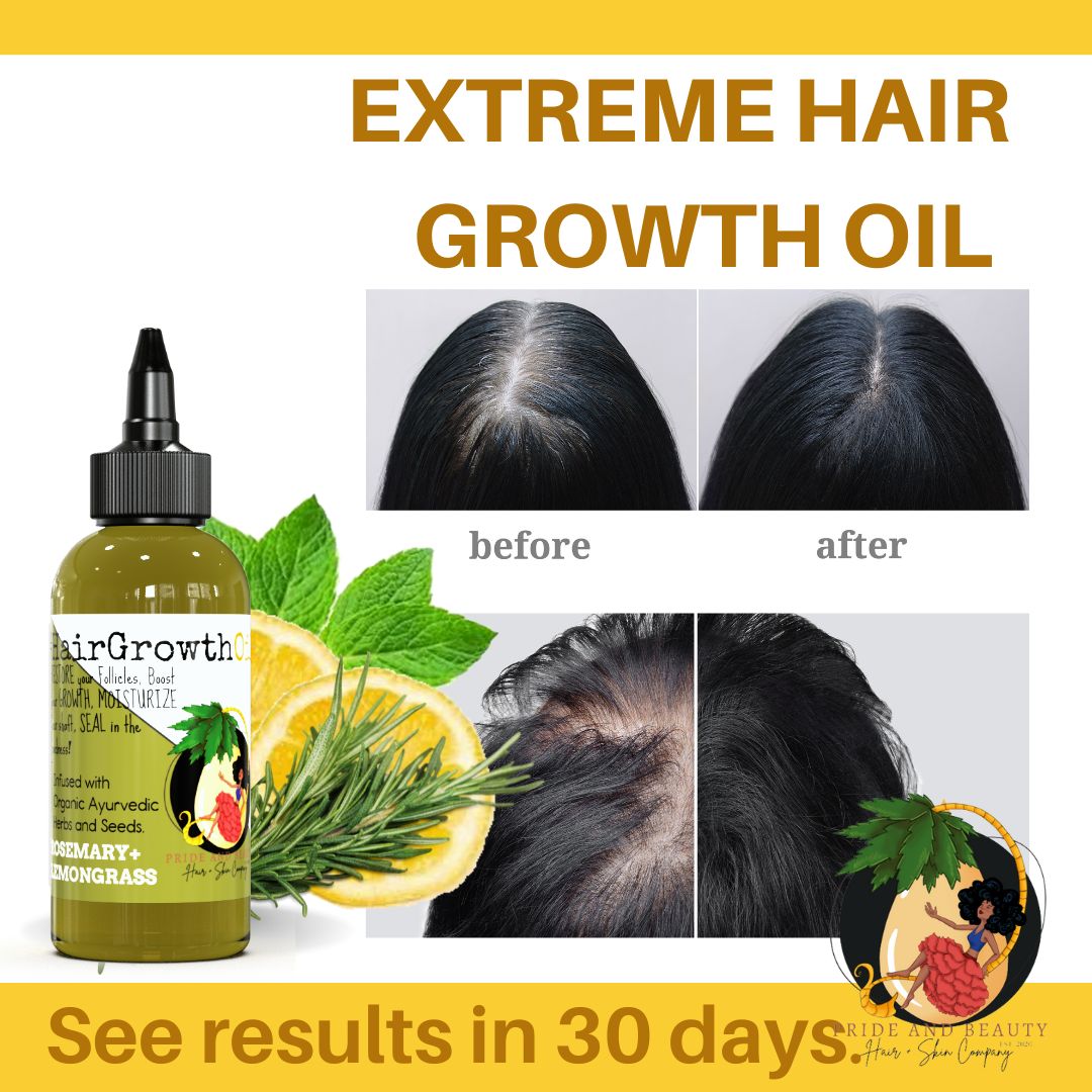 Rosemary Oil For Hair Growth - (Biotin+MSM)